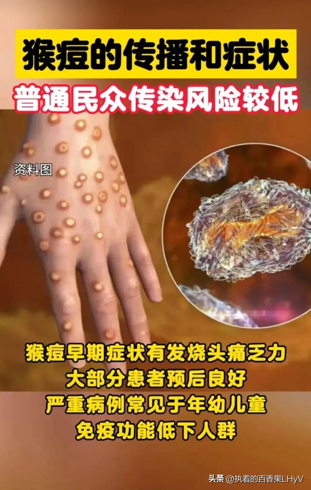 全球疫情最新数据总数报告