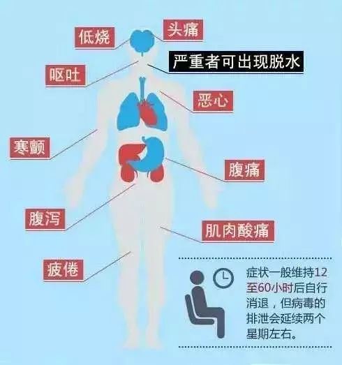 疫情是由哪种病毒引起的原因