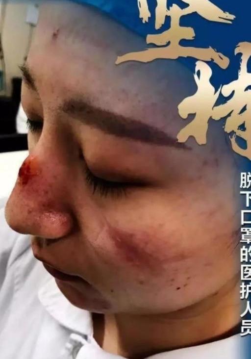 武汉疫情那一年，挑战与希望交织的时刻