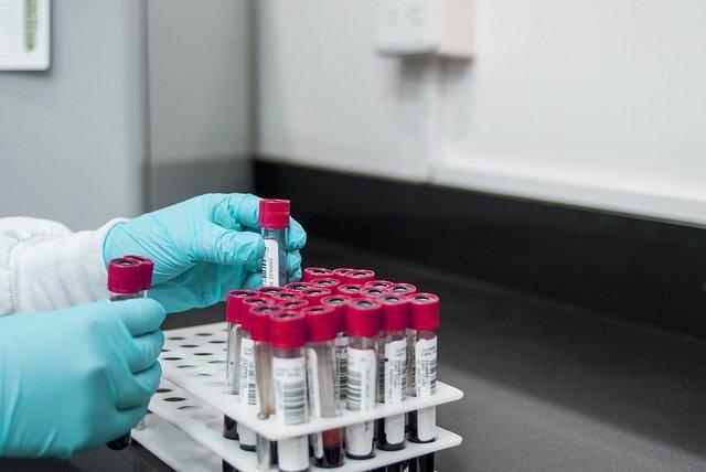 全球疫情最新情况数据图片分析