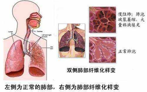 新冠肺炎防治第九版，深入理解与实践应用指南