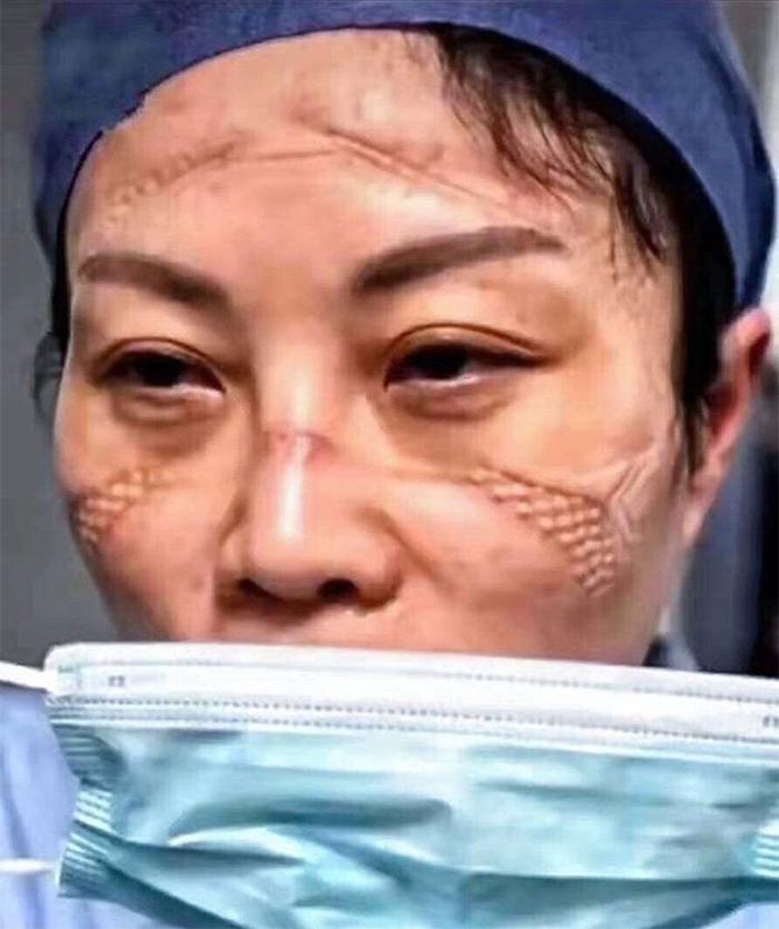 武汉疫情死亡人数及其深远影响